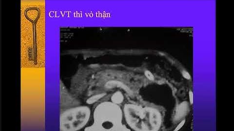 Chẩn đoán hình ảnh | Hệ tiết niệu (phần 2)