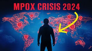 MPOX OUTBREAK 2024: What You Need to Know to Stay Safe