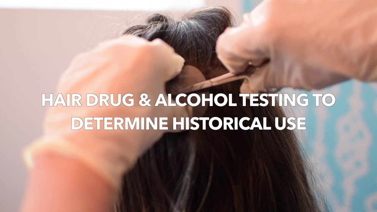 What samples can be used for DNA, Drug and Alcohol Testing? YouTube
