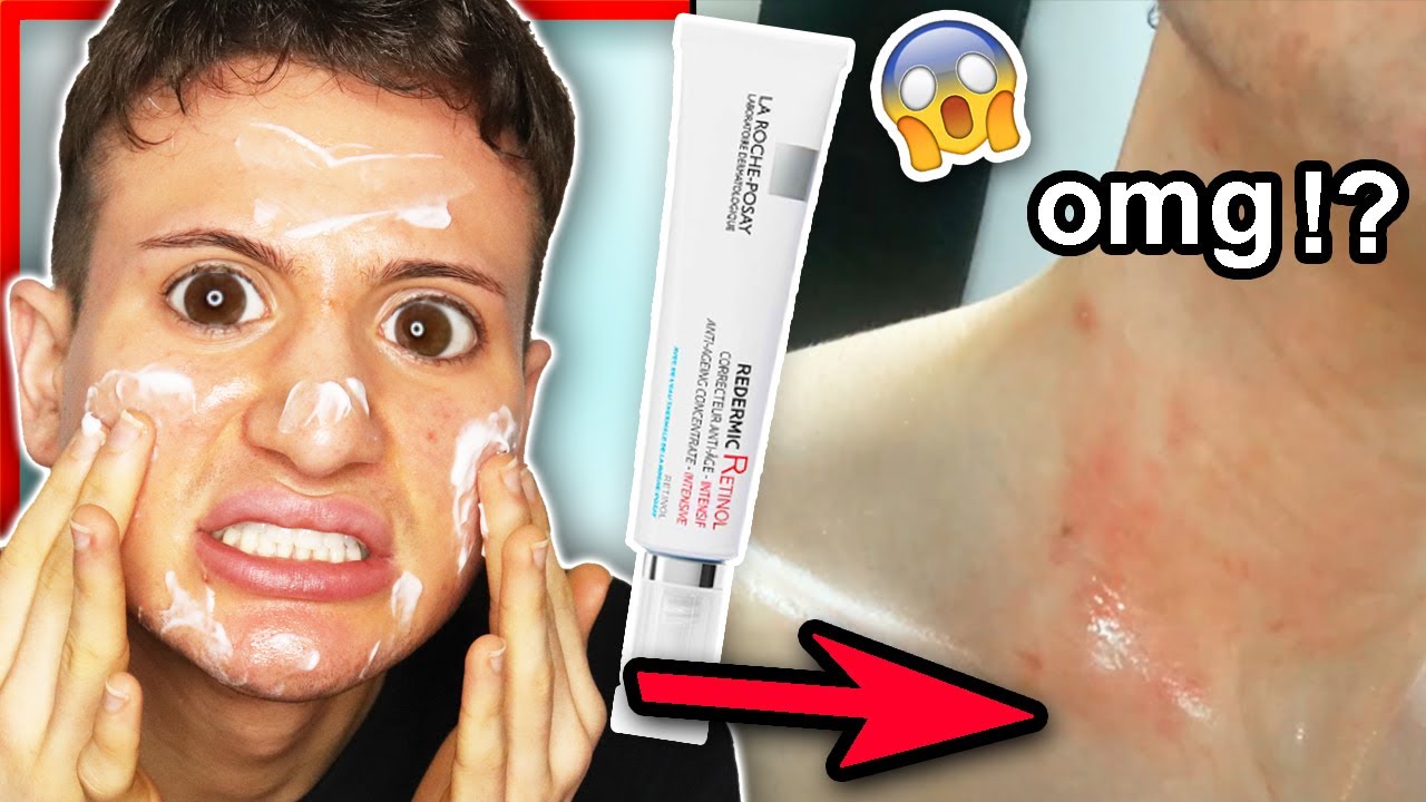 I tried La Roche Posay Redermic R Retinol for WEEKS!! (my reacted badly...) - YouTube