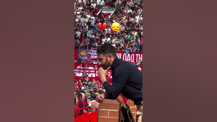 You Won't Believe Amorim’s Reaction to LENY Yoro Injury #mufc #mutv #manutd @manutd