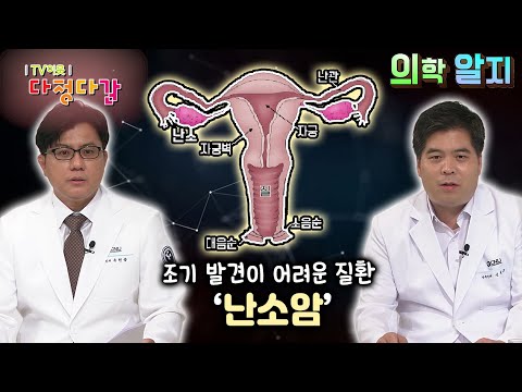 ‘의학 알지’ 난소암 / KBS대전 20210624방송