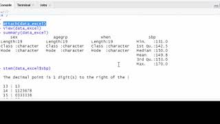 Attach/Detach in R (HD quality)