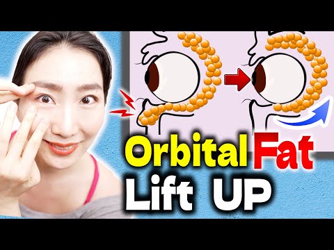 Kako naravno dvigniti padajočo orbitalno maščobo in odstraniti vrečke pod očmi