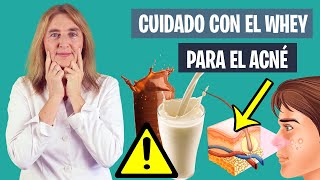 La VERDAD del ACNÉ y los SUPLEMENTOS de PROTEÍNA | Proteínas y acné | Nutrición deportiva