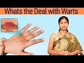 Overview of Skin Warts (Verrucae) | What Causes Them? Who Gets Them? || Dr. P. Swapna Priya