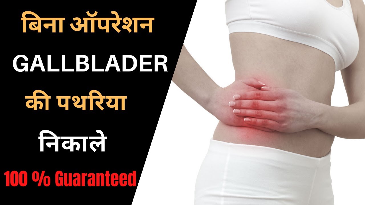 Gallbladder stone treatment without operation in hindi gallstone