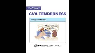 🚨 CVA Tenderness = Kidney Infection Red Flag! | NCLEX Bootcamp Cheat Sheet