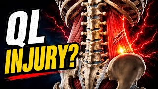 One-Sided Low Back Pain? QL Muscle Strain Rehab