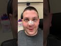 Septorhinoplasty/Sinus Surgery 24 hours ago
