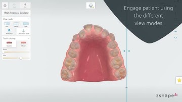 TRIOS Treatment Simulator Commercial movie 2023