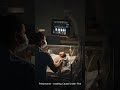 Pediatric nursing