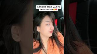 Kanino nag pagawa? FB: S & J cosmetic surgery clinic kay doc Jara! ❤️#rosmar #trending #youtube