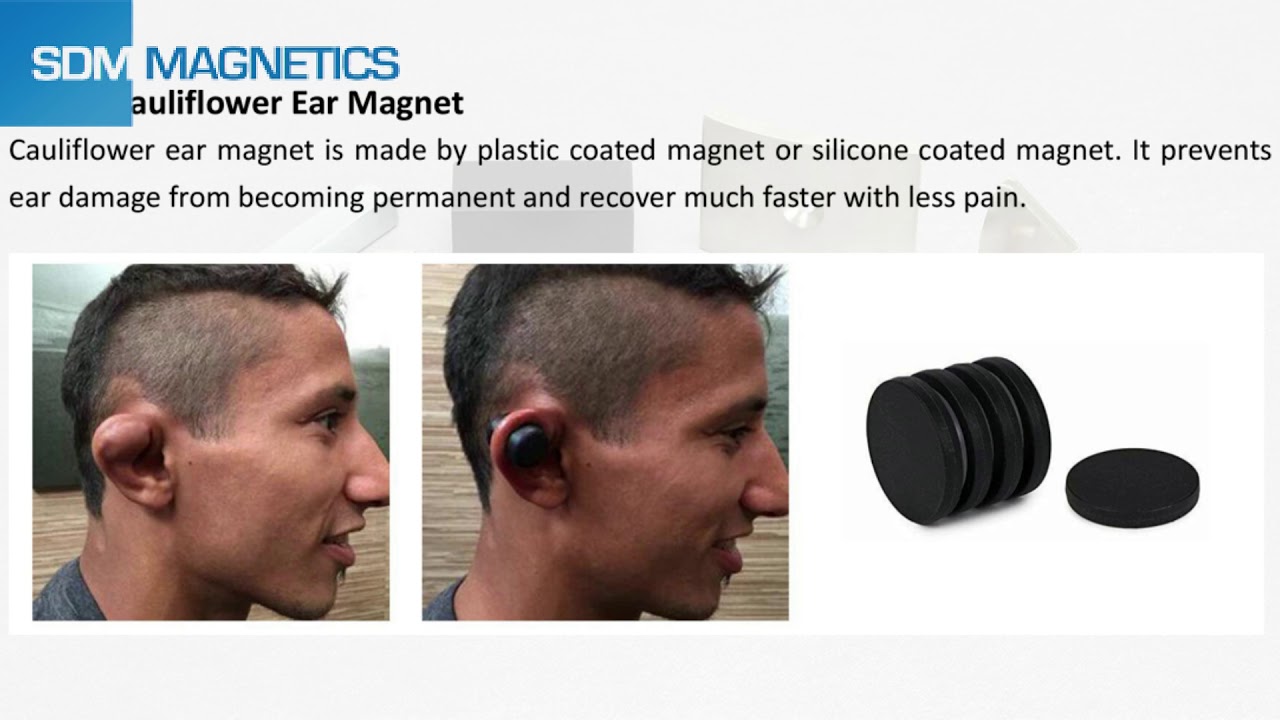 Some Introduction of Cauliflower Ear Magnet - YouTube