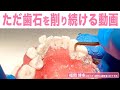 ただ無心に歯石を除去し続ける！【福岡 博多の口コミでおすすめと評判のむらつ歯科】歯石が気になる方におすすめです。