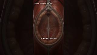 🩺 ¿Alguna vez te has preguntado cómo se ve una hernia umbilical por dentro?