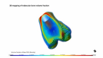 Creating Vector Fields & Volume Fraction with the Bone Analysis tool of Dragonfly.