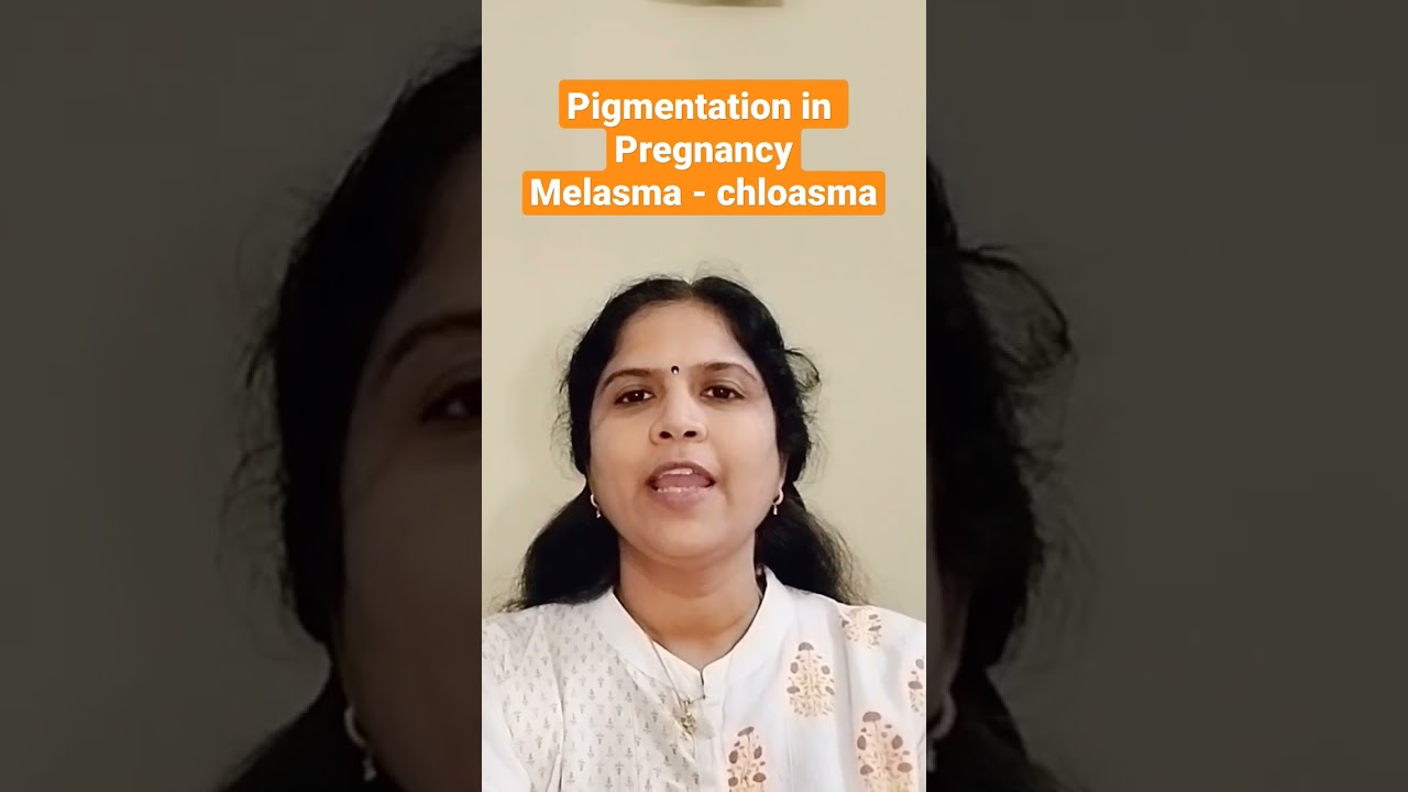 | Pigmentation in pregnancy | dark skin |  melasma  | in Tamil | Dr.Coperundevi | happy tamilnadu