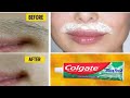 In 5 Minutes, Remove Unwanted Face Hair, NO SHAVE NO WAX, Unwanted Hair Removal II NGworld