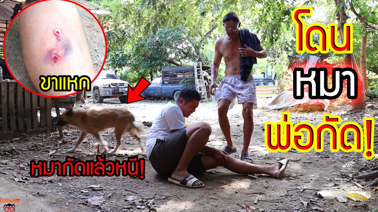 หมาสุดที่รักกัดลูกชาย! พ่อจะด่าหมา หรือ ด่าลูก ?
