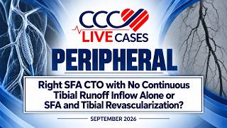 Right SFA CTO with No Continuous Tibial Runoff Inflow Alone or SFA and Tibial Revascularization