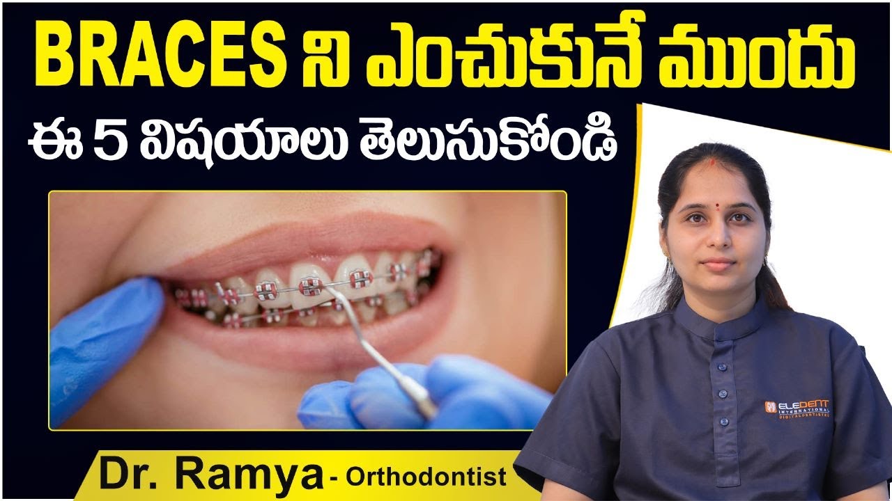 Bracesఎప్పుడు తీసుకోవాలి? 5 Things To Know Before Getting Dental