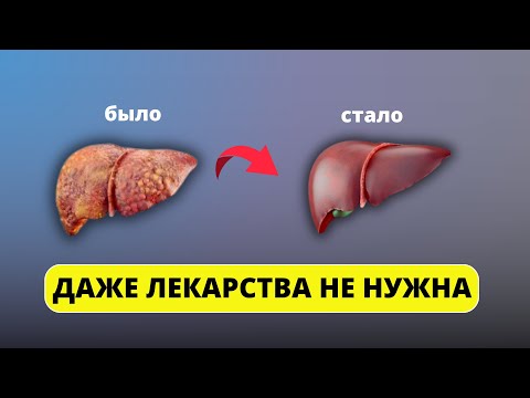 Очистите печень БЕЗ ТАБЛЕТОК! Печень САМА выплюнет все токсины...