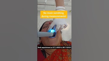 Intra Oral Scanner- Teeth measurements without nausea & vomitting; Dr. Srishti Bhatia #teeth