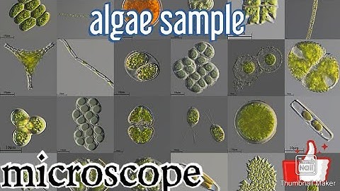 Algae in microscope | algae sample