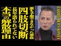 【衝撃】KONTAが不慮の事故で両手両足を切断された真相...再起不能なほどボロボロになった現在の姿に言葉を失う...『BARBEE BOYS』として活躍していた彼と三上博史との”親密”関係とは...