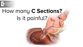 What is more painful C section or natural birth?-Dr. Mini Salunkhe of C9 Hospitals | Doctors’ Circle