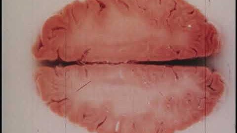 The Human Brain: A Dynamic View... (Robert B. Livingston and Univ of California, 1975)
