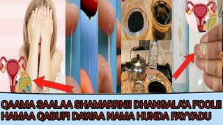 Qaama Saalaa Shamarrnii Dhangalaa Foolii Hamaa Qabufi Dawaa Nama Hunda Fayyadu