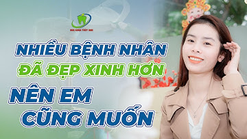 Sự Khác Biệt Giữa Nụ Cười Hở Lợi Và Không Hở Lợi
