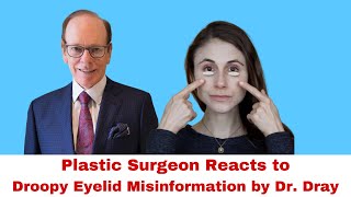Droopy Eyelids | Plastic Surgeon Reacts to Dr. Dray