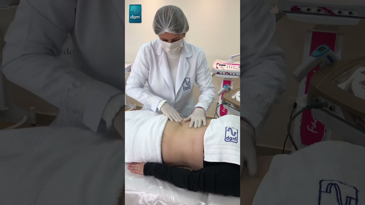 TRATAMENTO DE GORDURA LOCALIZADA COM RADIOFREQUENCIA