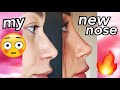 I GOT A NEW NOSE. | MyLifeAsEva