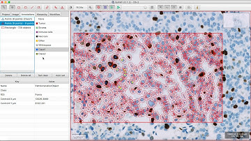 Cell Classification using QuPath