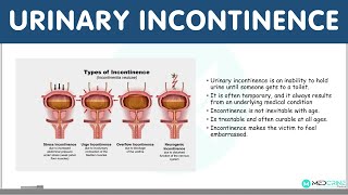 Urinary Incontinence: Definition, Types, Causes, Diagnosis and Treatment