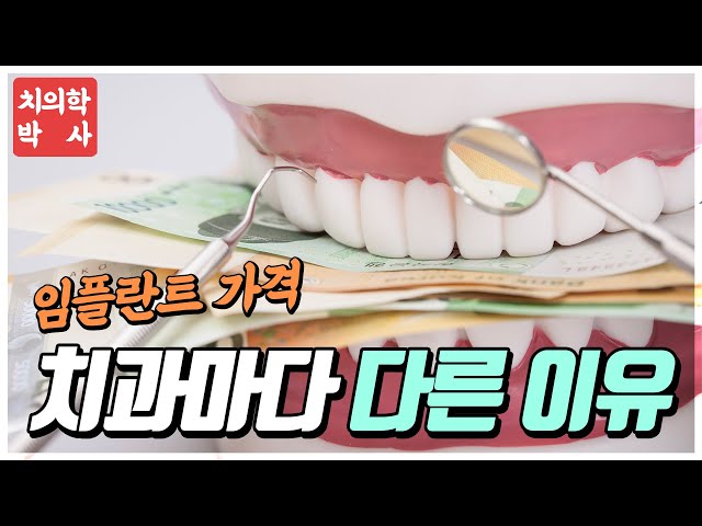 임플란트 가격이 치과마다 다른 이유?!