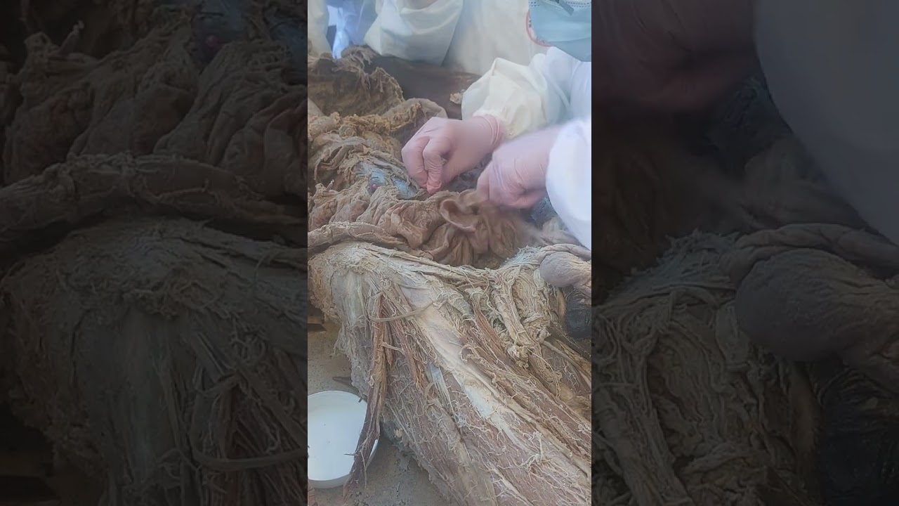 Cubiculo 2 Intestino grueso y delgado