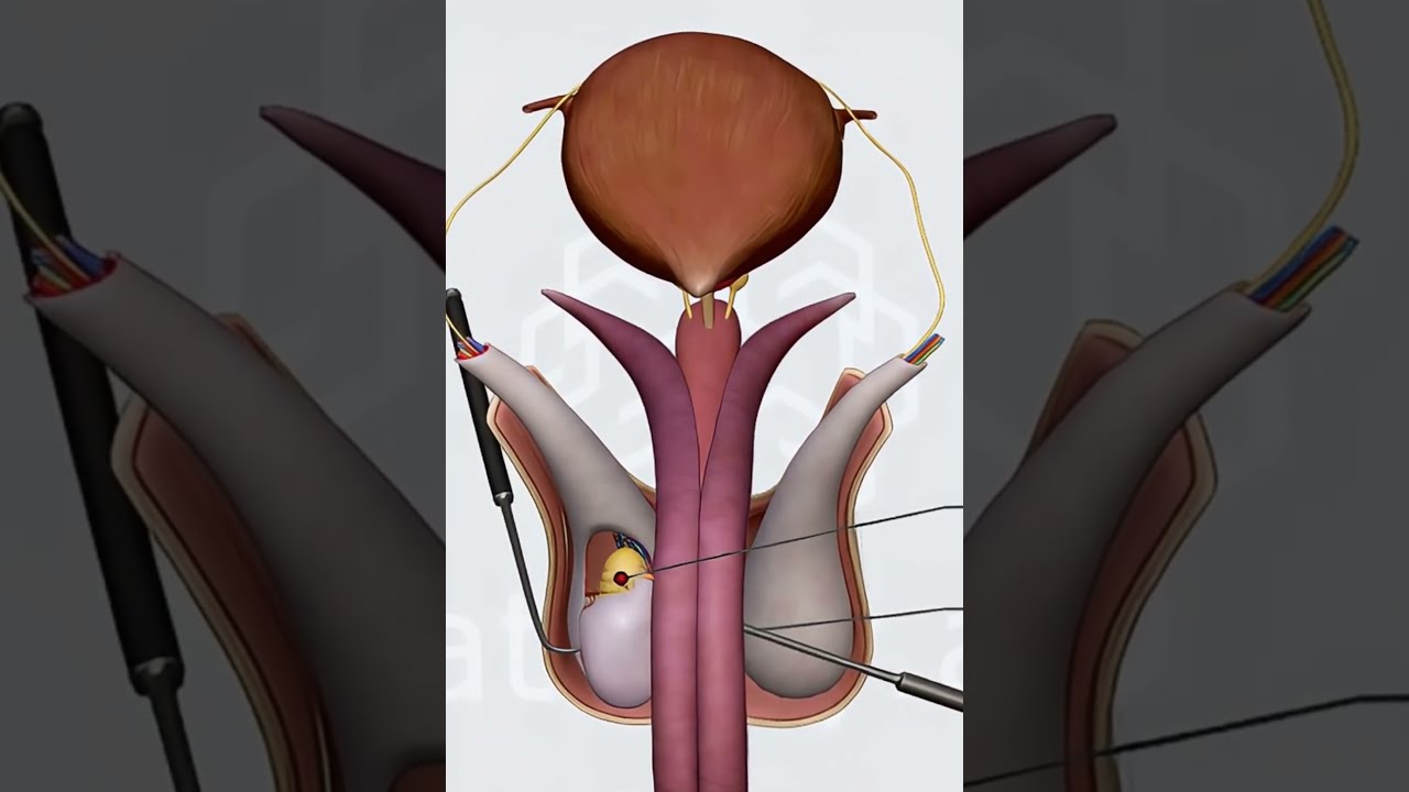 Male Pelvis Anatomy 3D Organs Vessels Reproductive Structures Explained Doctor
