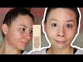 This foundation COVERED my ACNE! | JOUER Essential High Coverage Crème Foundation