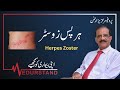 Ref:bN82wDAHyDw Urdu:            | herps zoster | medurstand by prof aziz ur rehman