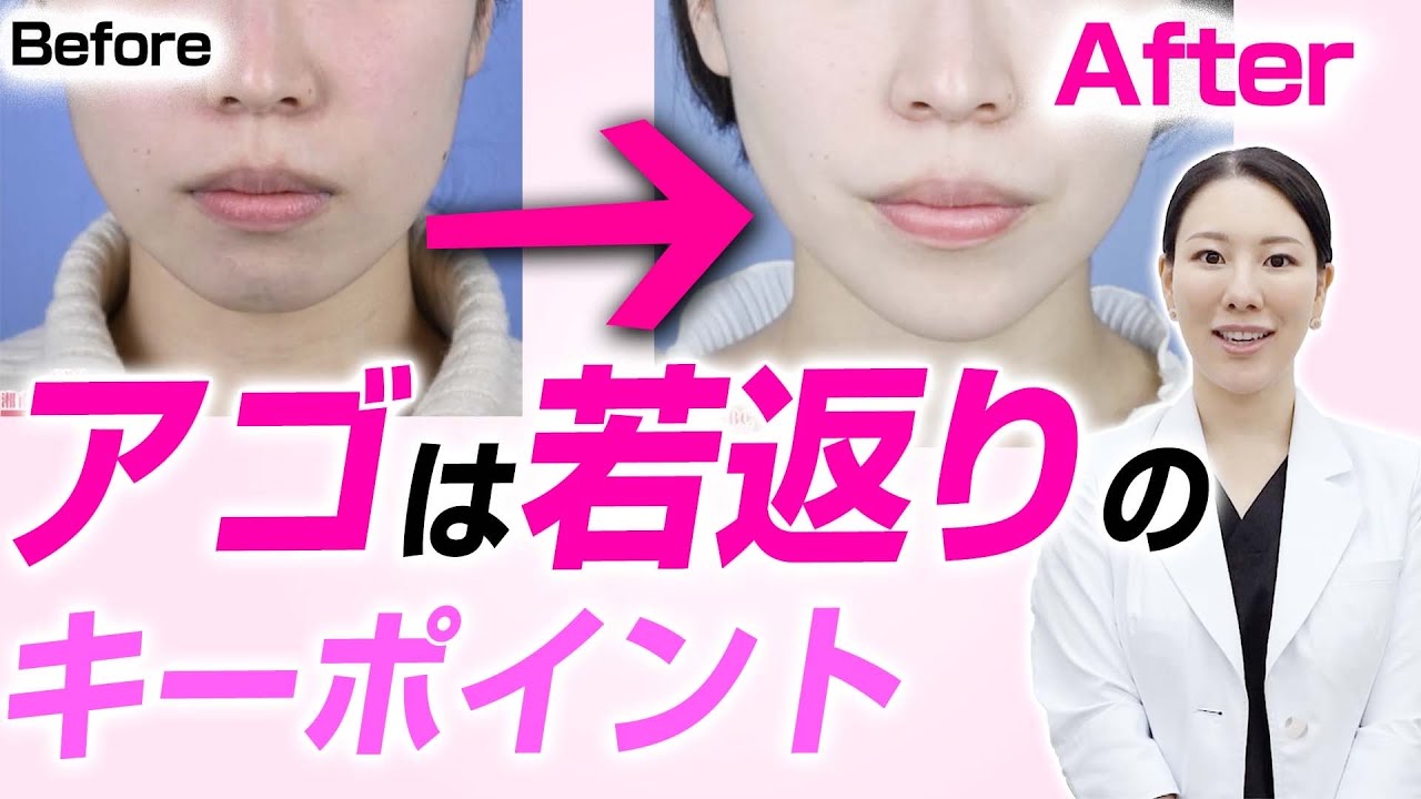 顎は若返りのキーポイントです。