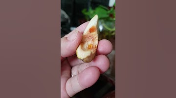 Cách làm trắng răng chỉ mất 1 phút từ vỏ cau !