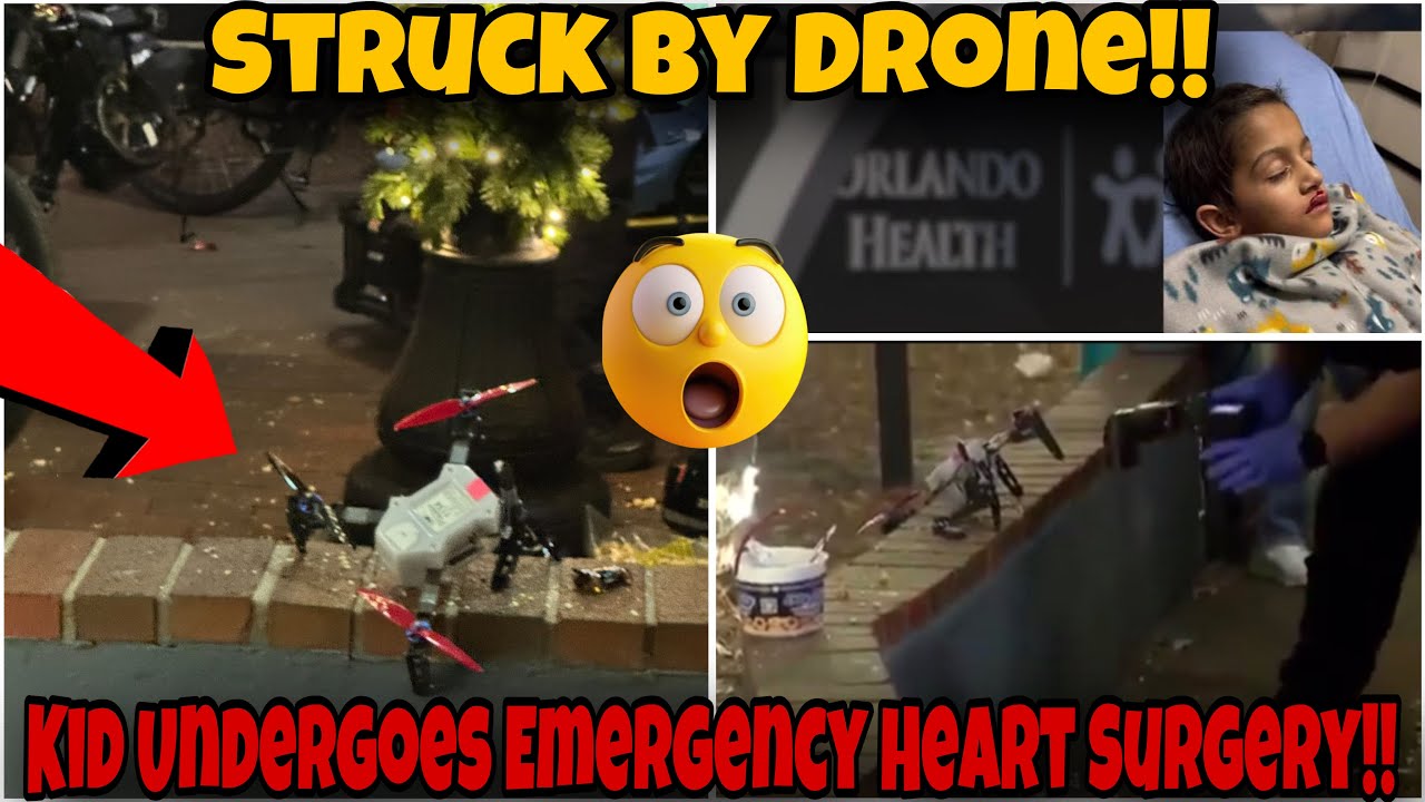 SCARY! Kid Undergoes OPEN HEART Surgery After Being Hit By DRONE At ...