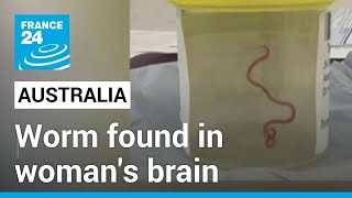 Worm found in woman's brain: 8cm creature was living in Australian woman's frontal lobe