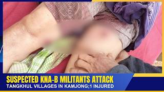 Suspected Kna-B Militants Attack Tangkhul Villages In Kamjong 1 Injured 07 May 2026