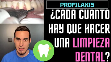 ¿Con qué frecuencia debo hacerme una limpieza dental con enfermedad periodontal?